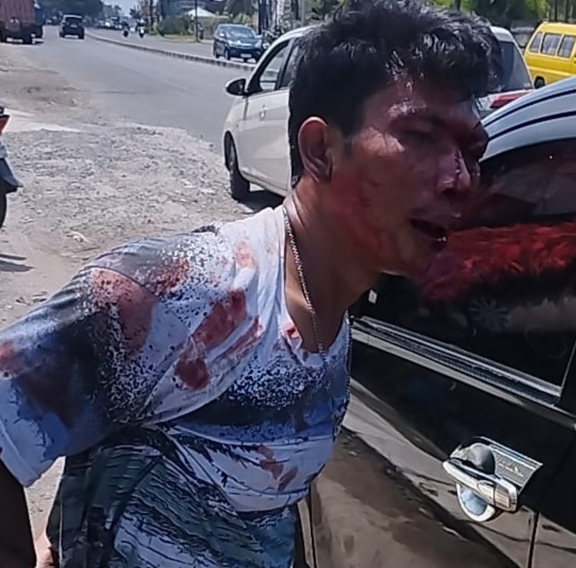 Pencuri Motor Berdarah-darah Dimassa, Kawan Kabur Selamatkan Diri
